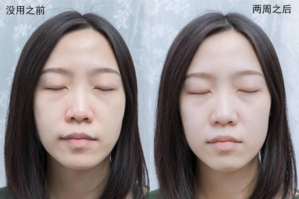 lg美容面罩有用么 lg美容面罩2周使用效果 lg美容面罩有用么 lg美容面罩2周使用效果