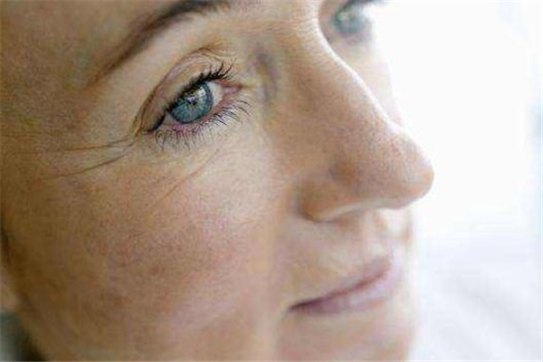 去除魚尾紋最有效的方法 去除魚尾紋最有效的方法