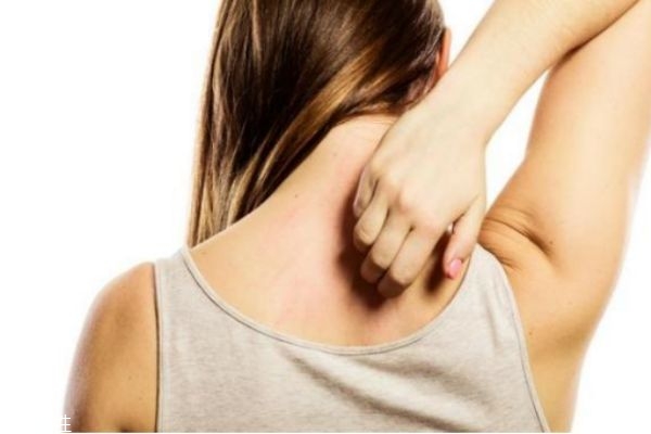 秋季皮膚干燥過(guò)敏癢怎么辦 秋季皮膚干燥癢 秋季皮膚干燥過(guò)敏癢怎么辦 秋季皮膚干燥癢