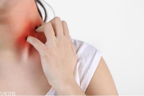 秋季皮膚干燥過(guò)敏癢怎么辦 秋季皮膚干燥癢 秋季皮膚干燥過(guò)敏癢怎么辦 秋季皮膚干燥癢