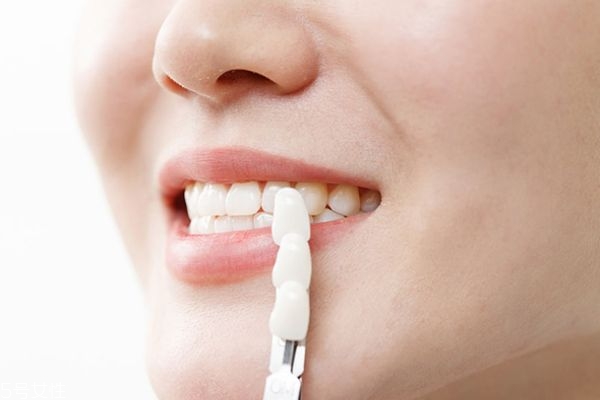 冷光美白牙齒儀器靠譜嗎 冷光美白儀原理 冷光美白牙齒儀器靠譜嗎 冷光美白儀原理