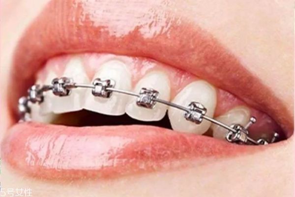 牙齒整形有危害嗎 牙齒整形的危害 牙齒整形有危害嗎 牙齒整形的危害