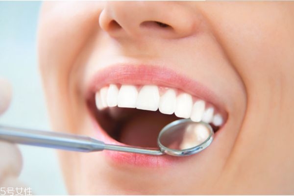 冷光美白牙齒多少錢 冷光美白牙齒后注意事項 冷光美白牙齒多少錢 冷光美白牙齒后注意事項