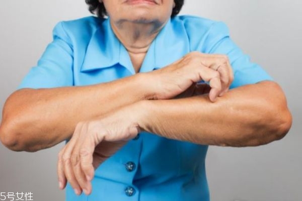 一到冬天皮膚就發(fā)癢是皮膚病嗎 可能和這有關