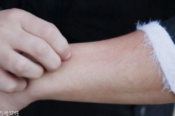 一到冬天皮膚就發(fā)癢是皮膚病嗎 可能和這有關