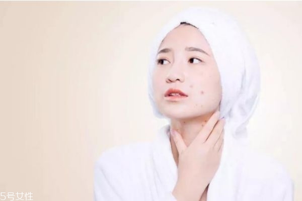 敏感肌膚會(huì)自己修復(fù)嗎 如何消滅敏感肌膚 敏感肌膚會(huì)自己修復(fù)嗎 如何消滅敏感肌膚