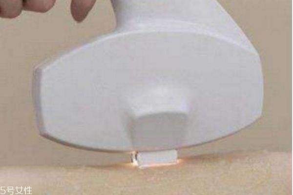 激光脫毛后還會(huì)長(zhǎng)嗎 激光脫毛能堅(jiān)持幾年 激光脫毛后還會(huì)長(zhǎng)嗎 激光脫毛能堅(jiān)持幾年