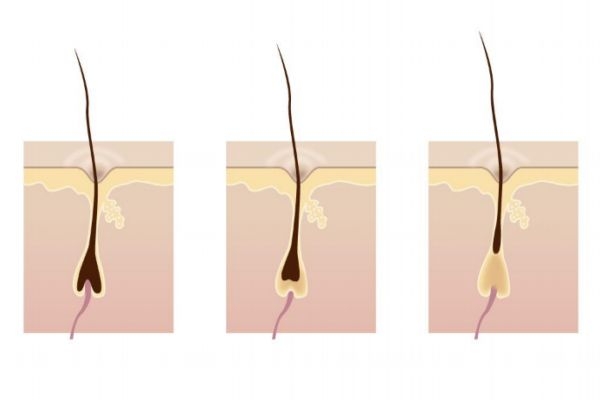 激光脫毛后還會(huì)長(zhǎng)嗎 激光脫毛能堅(jiān)持幾年 激光脫毛后還會(huì)長(zhǎng)嗎 激光脫毛能堅(jiān)持幾年