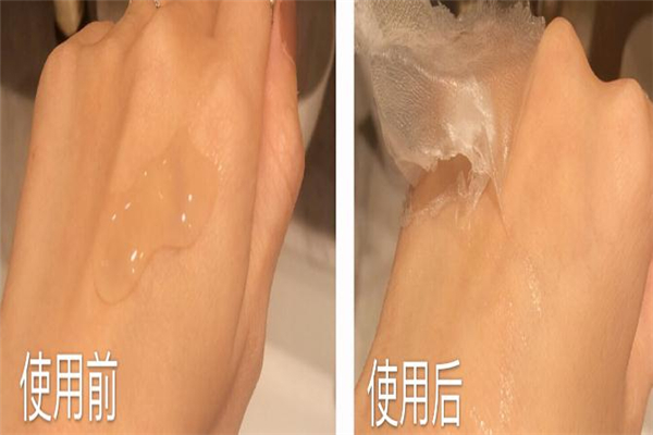 乾佰納生物膜多少錢 醫(yī)用生物修復(fù)膜 乾佰納生物膜多少錢 醫(yī)用生物修復(fù)膜