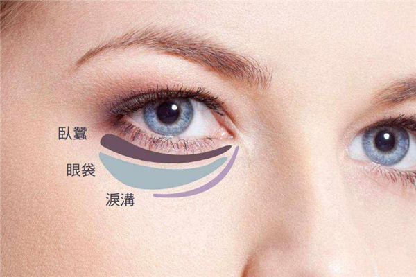 超聲波去眼袋能保持多久 看個人保養(yǎng)情況 超聲波去眼袋能保持多久 看個人保養(yǎng)情況