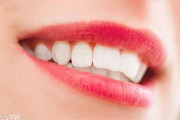 洗牙會疼痛嗎 洗牙會不會傷害牙齒 洗牙會疼痛嗎 洗牙會不會傷害牙齒