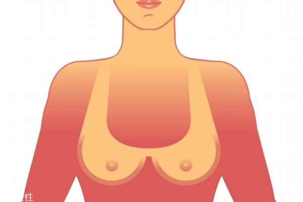 乳房濕疹治療建議 乳頭濕疹吃什么好 乳房濕疹治療建議 乳頭濕疹吃什么好