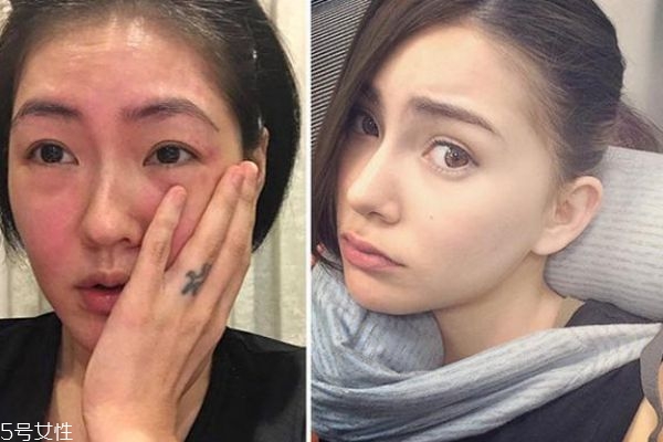 敏感肌怎么判斷 你是哪一種敏感肌 敏感肌怎么判斷 你是哪一種敏感肌