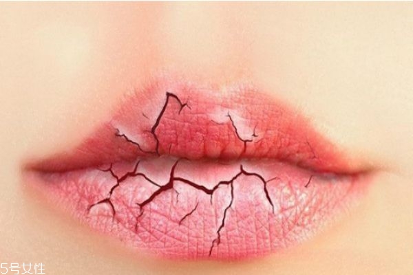 嘴唇干裂怎么辦,小妙招解決 嘴唇干裂怎么辦,小妙招解決