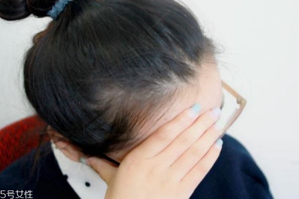 ?高血壓動(dòng)脈硬化引起頭暈 刮痧有效緩解 ?高血壓動(dòng)脈硬化引起頭暈 刮痧有效緩解