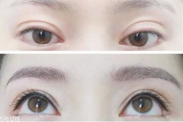 紋美瞳線多久恢復(fù) 美瞳線效果 紋美瞳線多久恢復(fù) 美瞳線效果