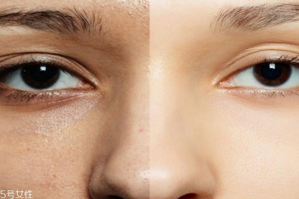 檸檬敷臉后要洗臉嗎 檸檬汁美容使用誤區(qū) 檸檬敷臉后要洗臉嗎 檸檬汁美容使用誤區(qū)