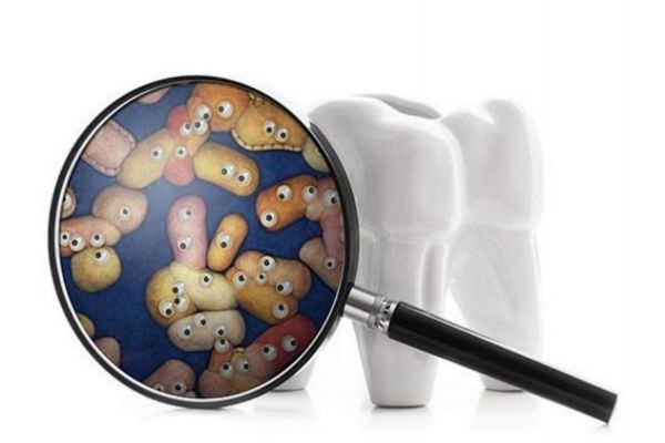 冷光美白牙齒要怎樣護(hù)理 牙齒冷光美白多少錢 冷光美白牙齒要怎樣護(hù)理 牙齒冷光美白多少錢