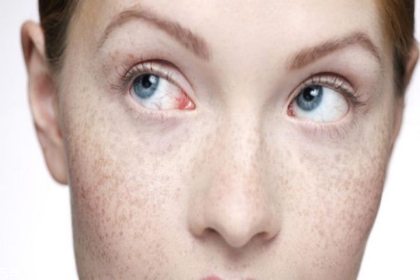 怎么區(qū)分斑和痣 3個(gè)方面來(lái)區(qū)分