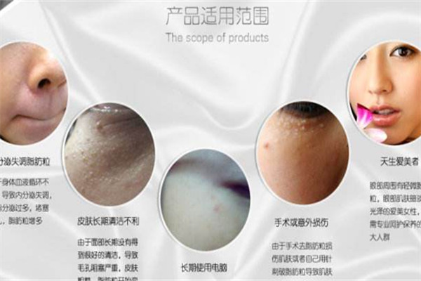 啤酒可以去除脂肪粒嗎 脂肪粒去除方法 啤酒可以去除脂肪粒嗎 脂肪粒去除方法