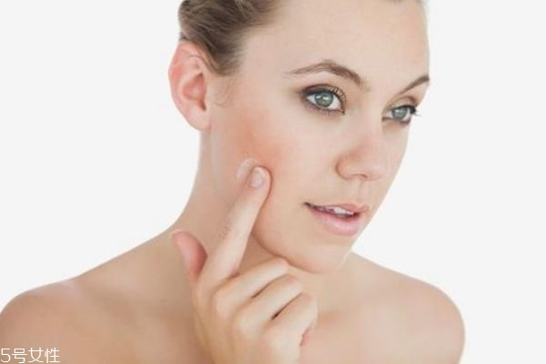 哪些護膚品不宜混搭使用 哪些成分絕對不能疊加 哪些護膚品不宜混搭使用 哪些成分絕對不能疊加