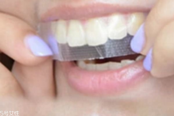 牙貼會(huì)損壞牙齒嗎 會(huì)有一定的傷害