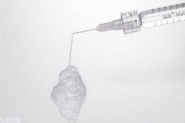 玻尿酸隆鼻外擴怎么辦 玻尿酸隆鼻會變寬嗎 玻尿酸隆鼻外擴怎么辦 玻尿酸隆鼻會變寬嗎