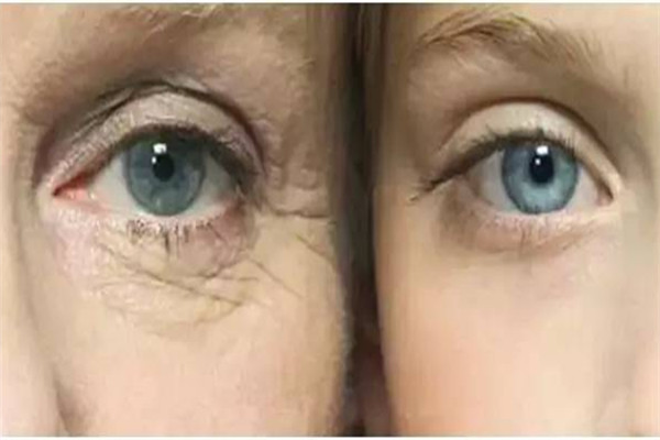 二十歲用什么眼霜比較好 二十歲用眼霜早嗎 二十歲用什么眼霜比較好 二十歲用眼霜早嗎