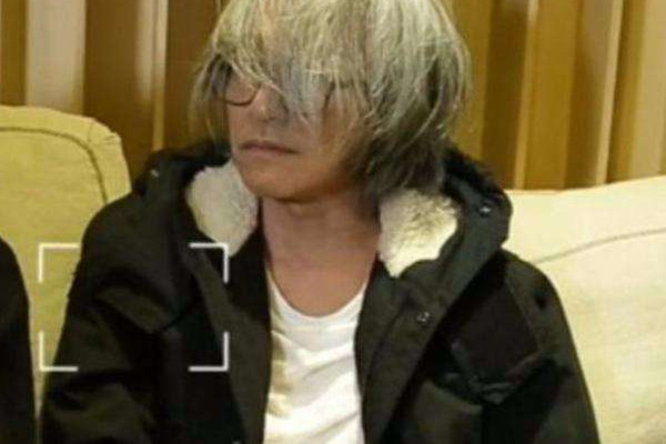 白頭發(fā)可以變黑嗎 頭發(fā)變黑的方法