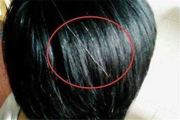 白頭發(fā)可以洗黑嗎 白頭的形成 白頭發(fā)可以洗黑嗎 白頭的形成