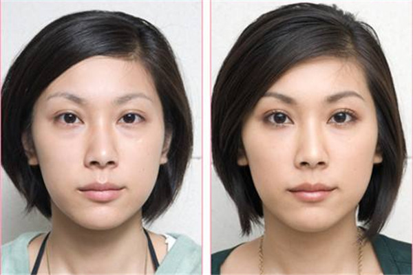 眼袋發(fā)黑怎么辦 去眼袋的方法 眼袋發(fā)黑怎么辦 去眼袋的方法