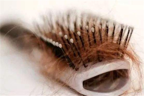 夏天為什么容易掉頭發(fā) 夏天掉頭發(fā)的原因 夏天為什么容易掉頭發(fā) 夏天掉頭發(fā)的原因