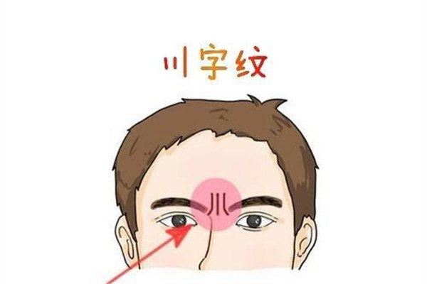 川字紋形成的原因是什么 原因是這樣 川字紋形成的原因是什么 原因是這樣