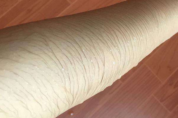 體毛多的原因是什么 原因是這樣 體毛多的原因是什么 原因是這樣