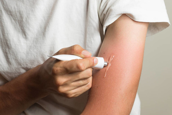 防曬指數(shù)怎么計算 防嗮的方法 防曬指數(shù)怎么計算 防嗮的方法