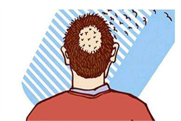 植發(fā)之后忌口嗎 植發(fā)之后要注意什么 植發(fā)之后忌口嗎 植發(fā)之后要注意什么