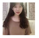 開(kāi)內(nèi)眼角要多久恢復(fù) 依個(gè)人體質(zhì)而定