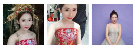 開(kāi)內(nèi)眼角要多久恢復(fù) 依個(gè)人體質(zhì)而定