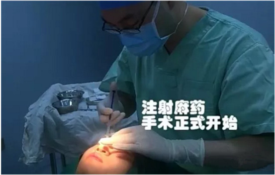 開(kāi)內(nèi)眼角要多久恢復(fù) 依個(gè)人體質(zhì)而定