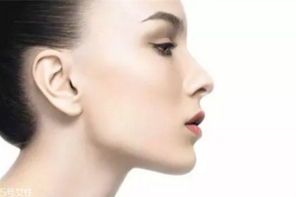 嗨體多久打一次 嗨體維持時間 嗨體多久打一次 嗨體維持時間