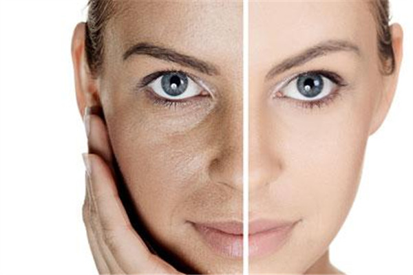 自體脂肪填充額頭的優(yōu)點是什么 自體脂肪的好處 自體脂肪填充額頭的優(yōu)點是什么 自體脂肪的好處