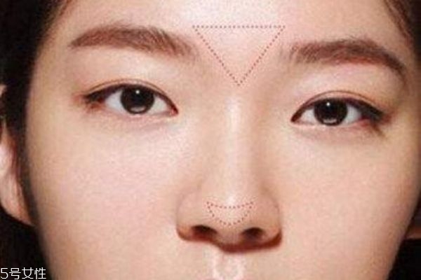 膨體隆鼻材料介紹 國產(chǎn)膨體品牌