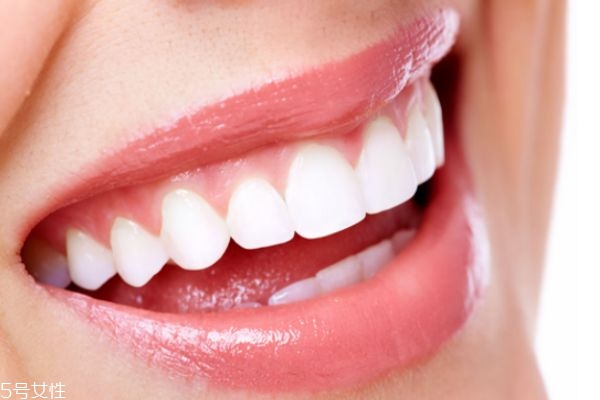 冷光美白后可以吃什么 冷光美白牙齒的注意事項(xiàng) 冷光美白后可以吃什么 冷光美白牙齒的注意事項(xiàng)