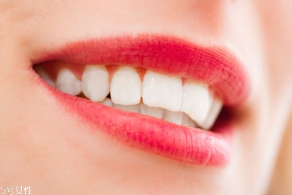 冷光美白儀真的有用嗎 唯愛牙齒冷光美白儀使用方法 冷光美白儀真的有用嗎 唯愛牙齒冷光美白儀使用方法