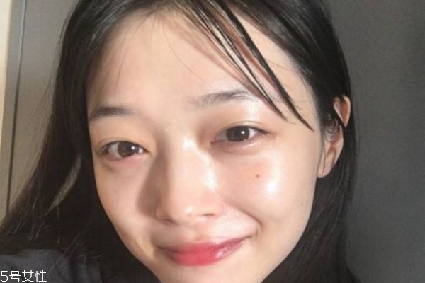 王者風(fēng)范做幾次有效果 王者風(fēng)范激光注意事項(xiàng) 王者風(fēng)范做幾次有效果 王者風(fēng)范激光注意事項(xiàng)