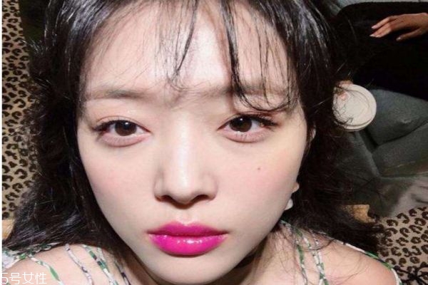 激光去痘印有風險嗎 激光去痘印的風險 激光去痘印有風險嗎 激光去痘印的風險