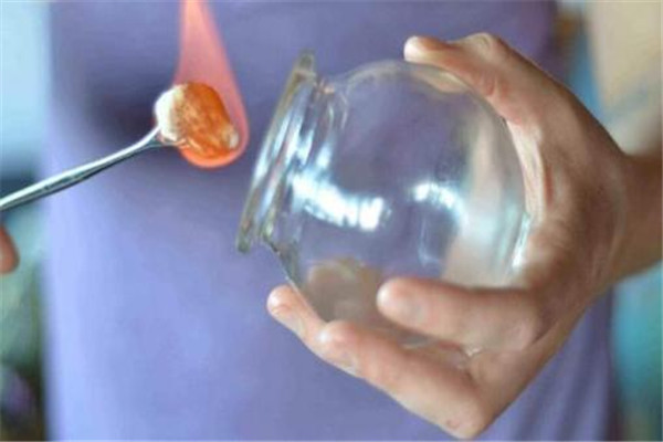 拔火罐不能吃什么 這些東西不能吃 拔火罐不能吃什么 這些東西不能吃