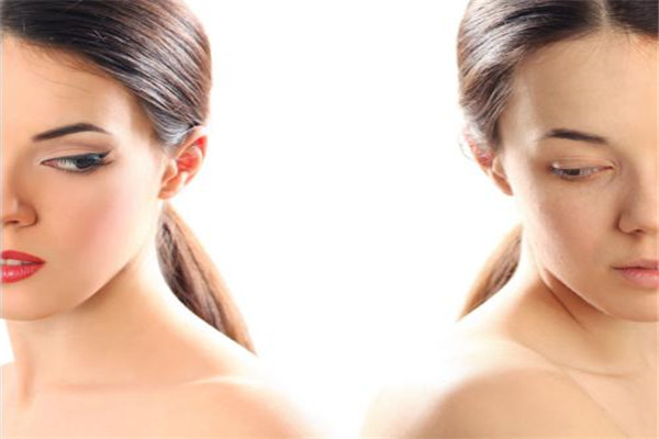 美杜莎雙眼皮多久恢復(fù) 美杜莎雙眼皮是什么 美杜莎雙眼皮多久恢復(fù) 美杜莎雙眼皮是什么