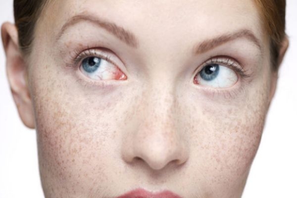 臉上有斑點用什么遮瑕效果好 口碑好的遮斑產(chǎn)品推薦 臉上有斑點用什么遮瑕效果好 口碑好的遮斑產(chǎn)品推薦