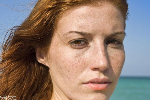 臉上有斑點用什么遮瑕效果好 口碑好的遮斑產(chǎn)品推薦 臉上有斑點用什么遮瑕效果好 口碑好的遮斑產(chǎn)品推薦